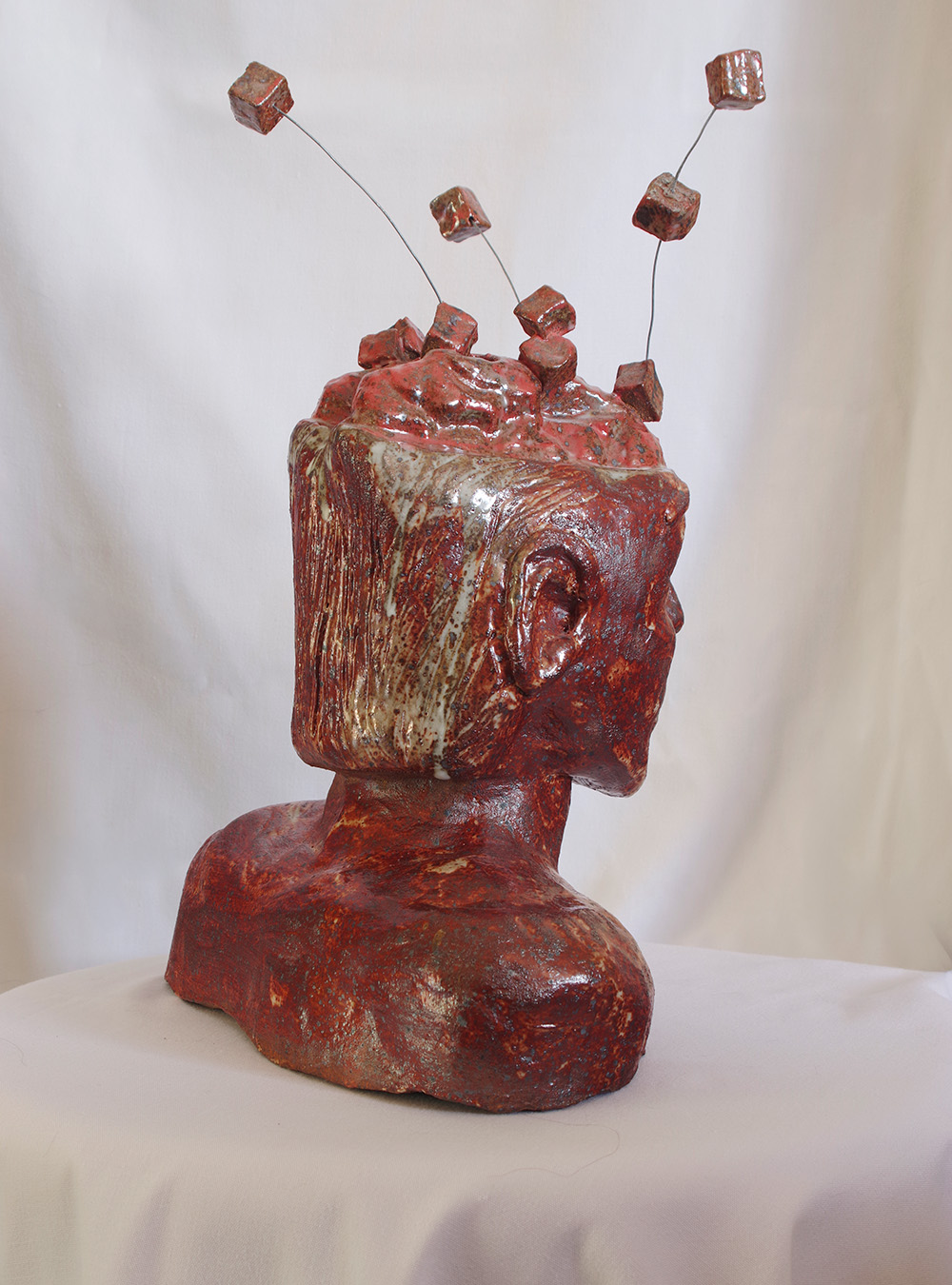 alzheimer head side alzheimer head side